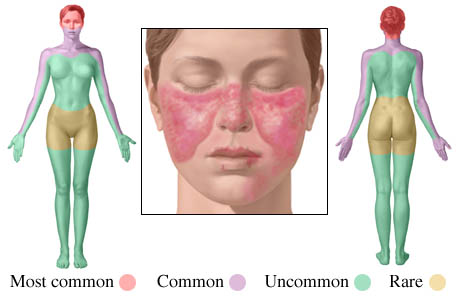 aree del lupus.jpg