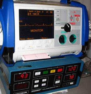 Cardioversione, Defibrillatore jpg.jpg