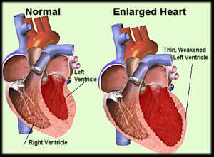 cardiomegalia.jpg