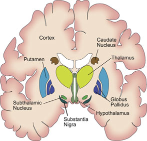 serotonina -immagine della sindrome.jpg