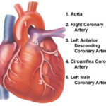 rp_angina-pectoris.jpg