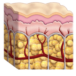 cellulite